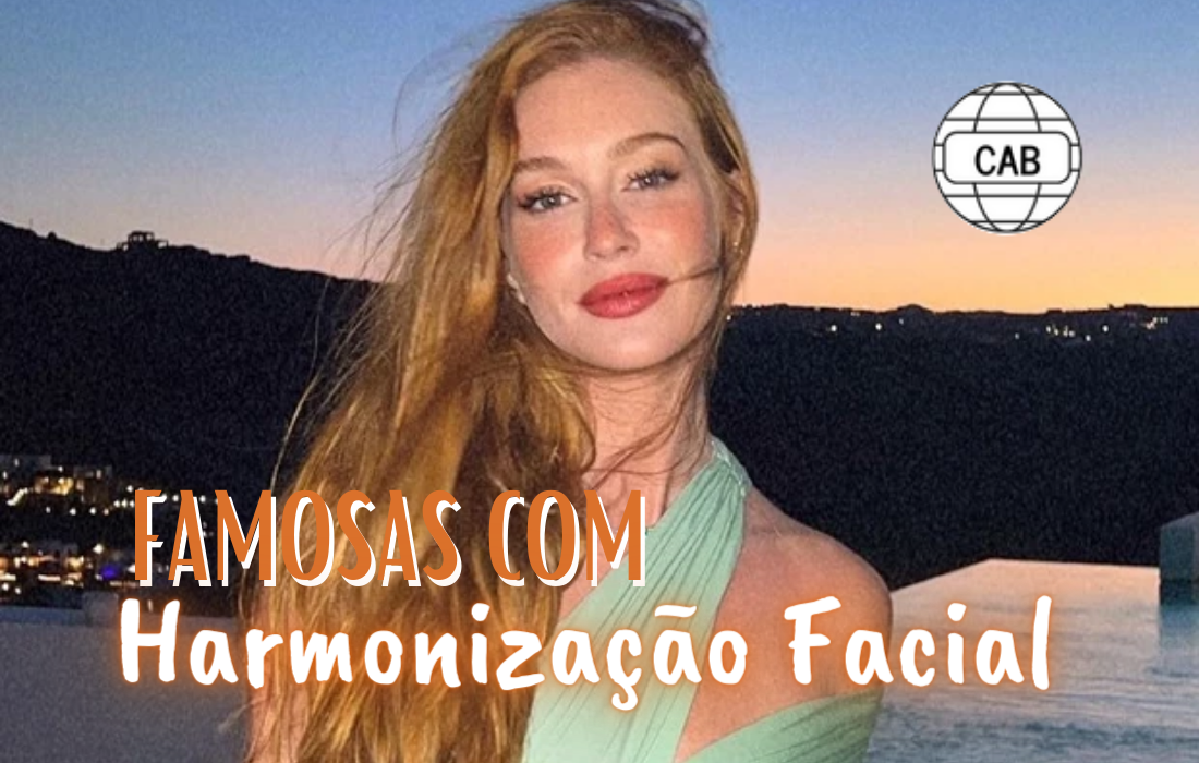 Famosas com Harmonização facial